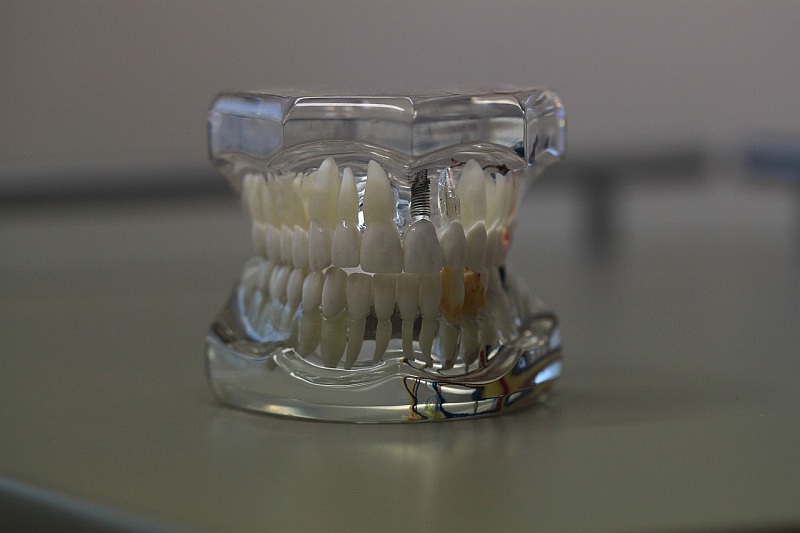 zobna-protektika